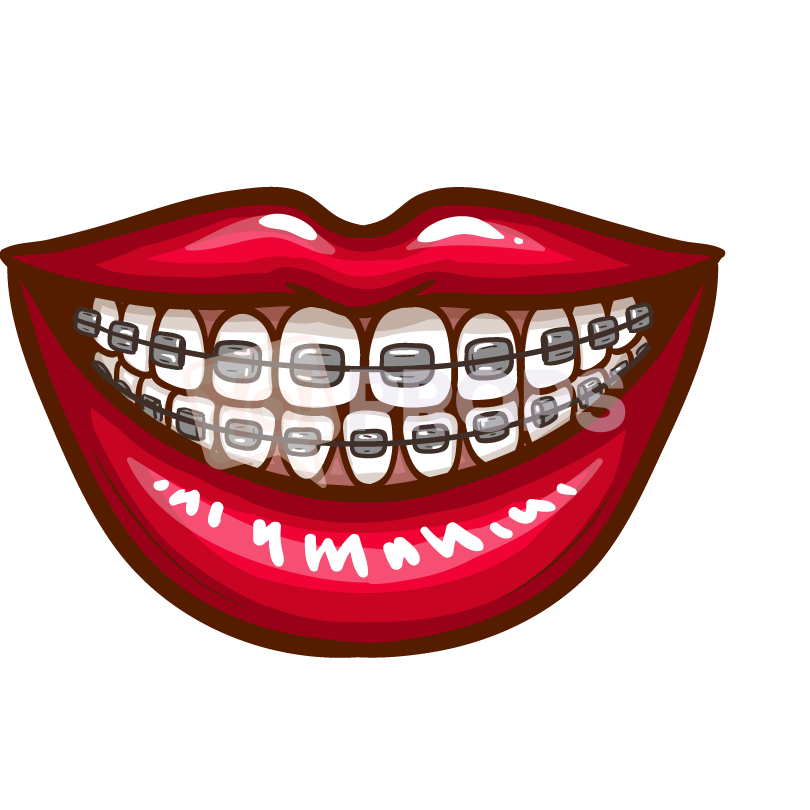 Mouth with Braces